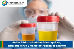 Ácido 5-hidroxiindolacético