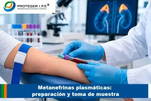 Metanefrinas plasmáticas