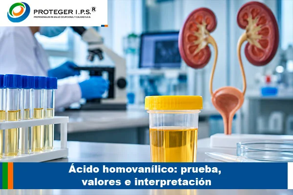 ácido homovanílico